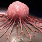 العلاج المناعي فعال ضد العديد من السرطانات