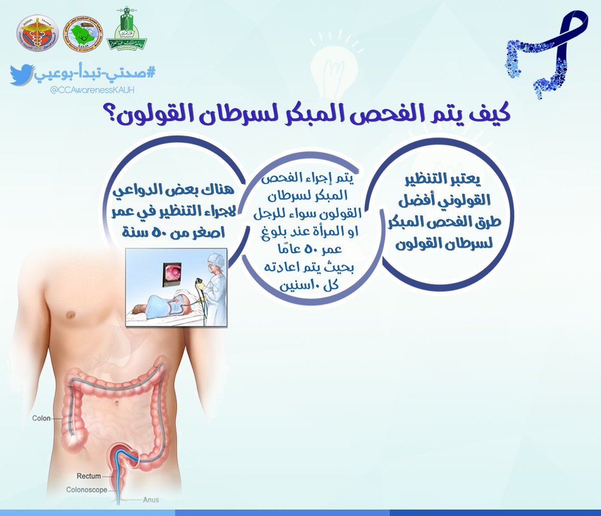 سرطان القولون – ما الذي أستطيع أن&hellip;